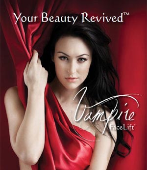 Vampire Facelift